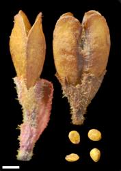 Veronica trifida. Capsule (calyx lobes removed). Scale = 1 mm.
 Image: P.J. Garnock-Jones © P.J. Garnock-Jones CC-BY-NC 3.0 NZ